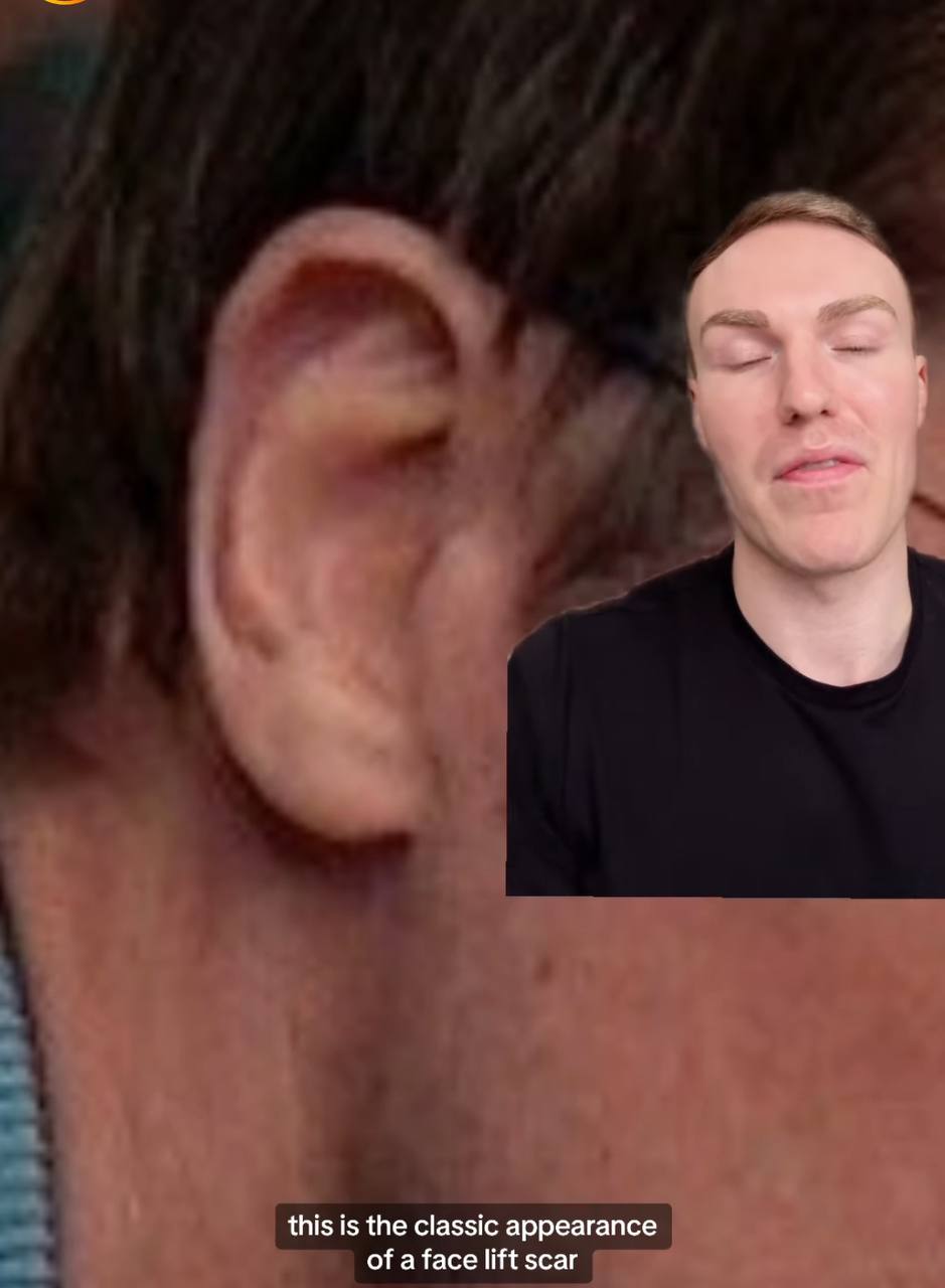 60-річний Бред Пітт зробив пластику обличчя: який вигляд зараз має актор (відео)